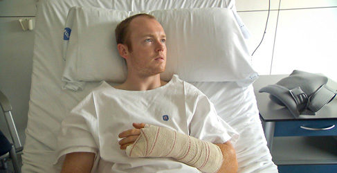 smith operacion mano